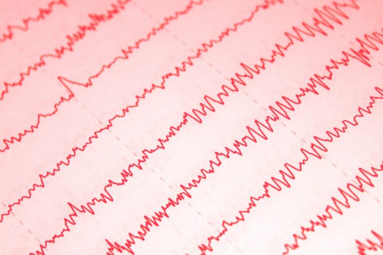 Wirtschaftliche Folgen der EEG-Reform Reiche für Solaranlagenbesitzer in Deutschland